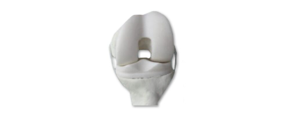 imgi_2_csm__cempadic_kniespacer_1fa2e845fa