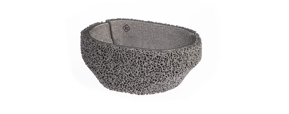 imgi_3_2-epore_cone_kortikal_tibial_2