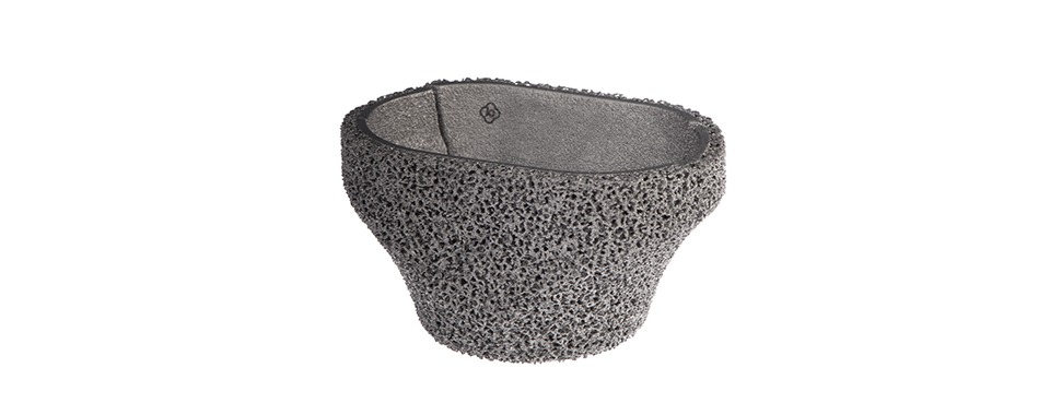 imgi_4_3-epore_cone_kortikal_tibial_1