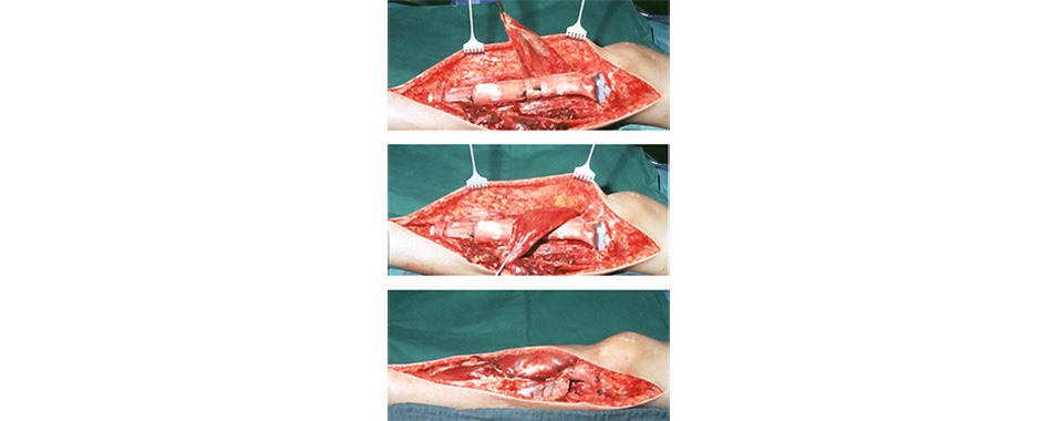 imgi_4__Anbindungsschlauch-3