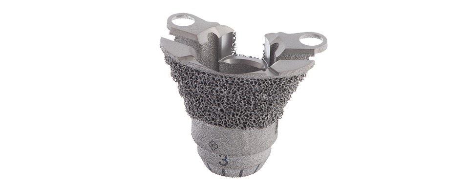 imgi_6_5-epore_met_tibial_2