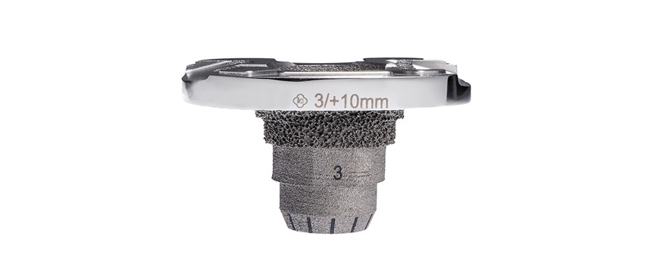 imgi_7_6-epore_met_tibial_4