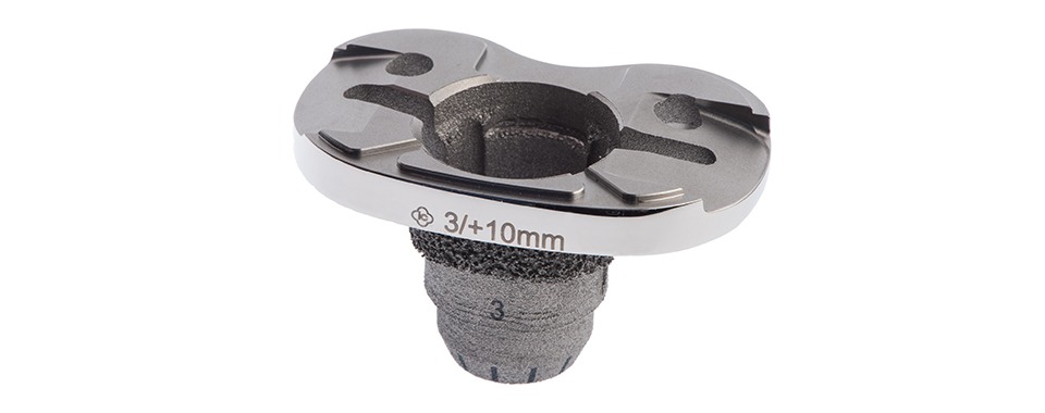 imgi_8_7-epore_met_tibial_3